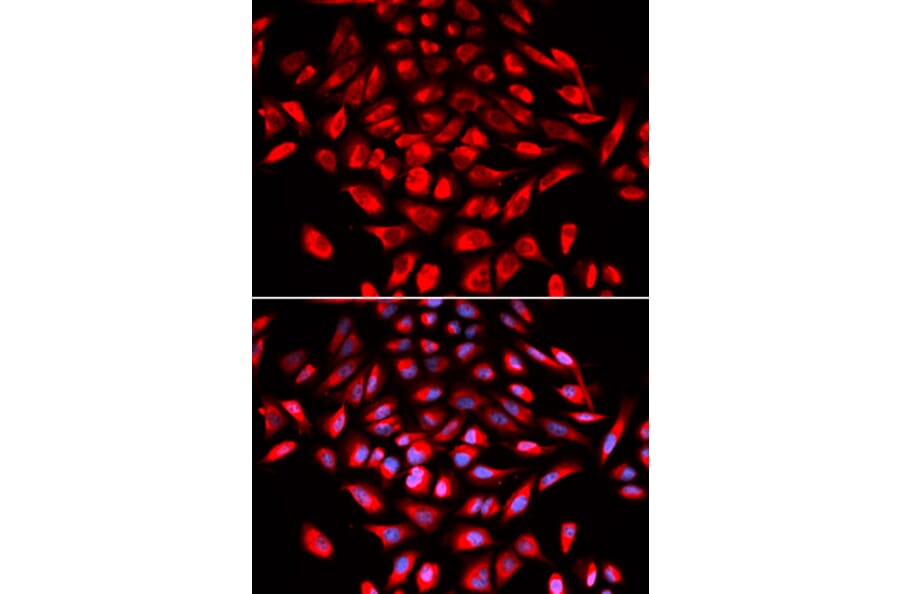 Immunofluorescence - CAMK4 Antibody from Signalway Antibody (32758) - Antibodies.com