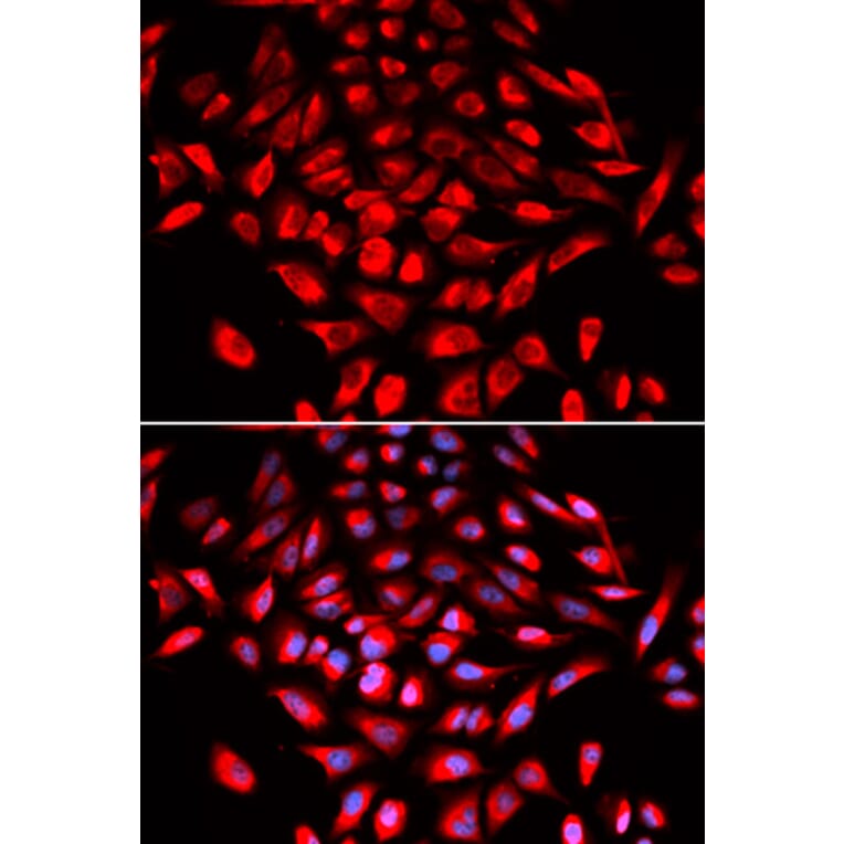 Immunofluorescence - CAMK4 Antibody from Signalway Antibody (32758) - Antibodies.com
