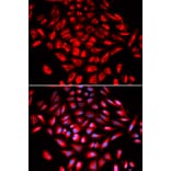 Immunofluorescence - CAMK4 Antibody from Signalway Antibody (32758) - Antibodies.com