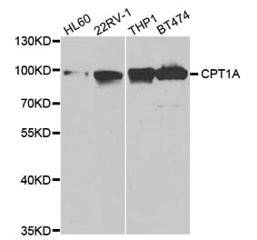 Western blot - CPT1A Antibody from Signalway Antibody (32761) - Antibodies.com