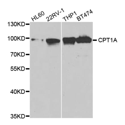 Western blot - CPT1A Antibody from Signalway Antibody (32761) - Antibodies.com