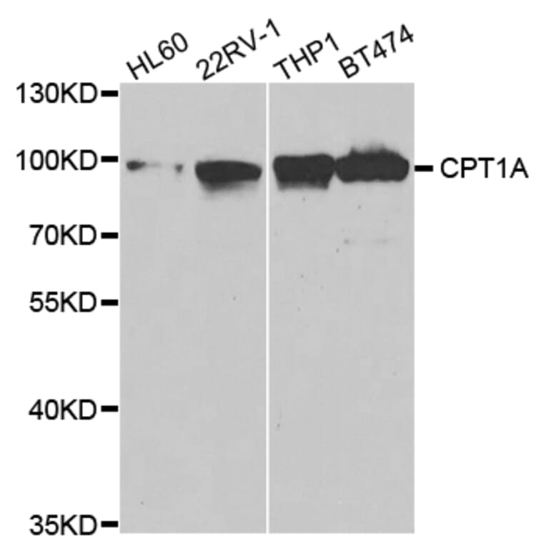 Western blot - CPT1A Antibody from Signalway Antibody (32761) - Antibodies.com