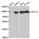 Western blot - CPT1A Antibody from Signalway Antibody (32761) - Antibodies.com