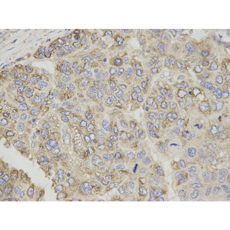 Immunohistochemistry - CPT1A Antibody from Signalway Antibody (32761) - Antibodies.com