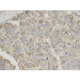 Immunohistochemistry - CPT1A Antibody from Signalway Antibody (32761) - Antibodies.com