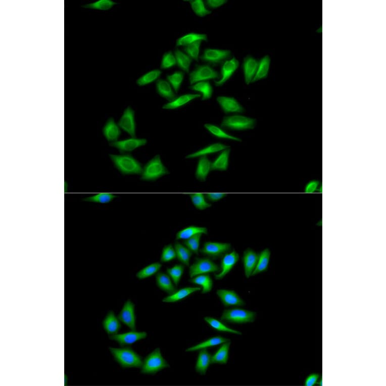 Immunofluorescence - CPT1A Antibody from Signalway Antibody (32761) - Antibodies.com