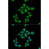 Immunofluorescence - CPT1A Antibody from Signalway Antibody (32761) - Antibodies.com