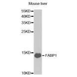 Western blot - FABP1 Antibody from Signalway Antibody (32764) - Antibodies.com