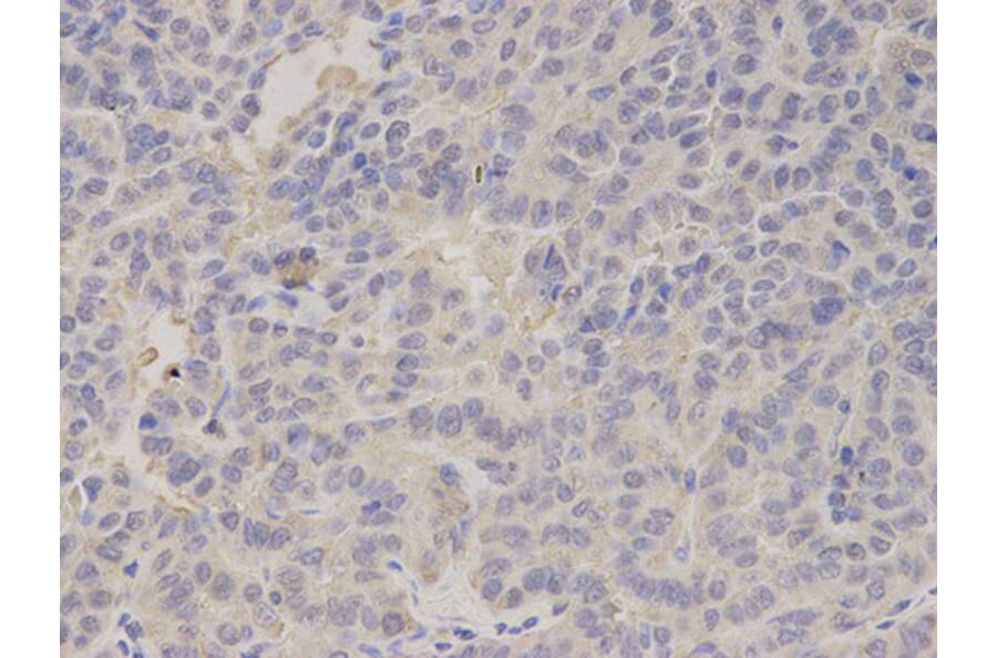 Immunohistochemistry - FABP1 Antibody from Signalway Antibody (32764) - Antibodies.com