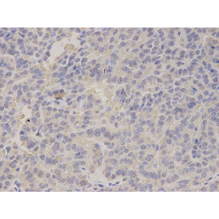 Immunohistochemistry - FABP1 Antibody from Signalway Antibody (32764) - Antibodies.com