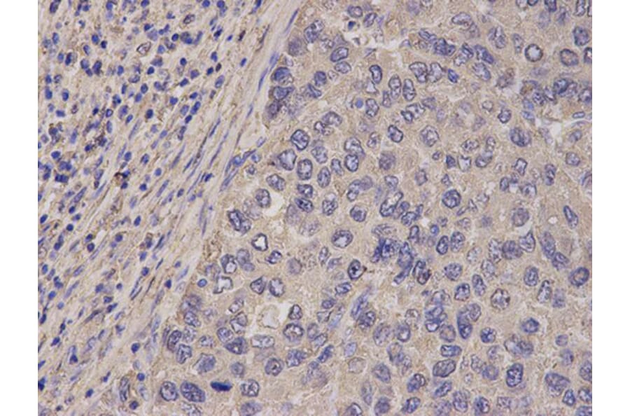 Immunohistochemistry - FABP1 Antibody from Signalway Antibody (32764) - Antibodies.com