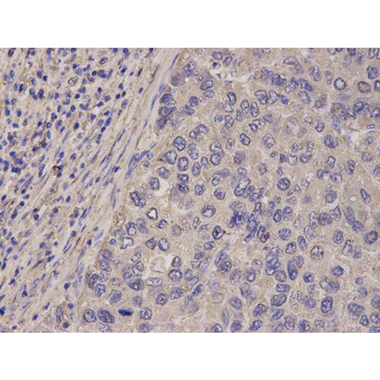 Immunohistochemistry - FABP1 Antibody from Signalway Antibody (32764) - Antibodies.com