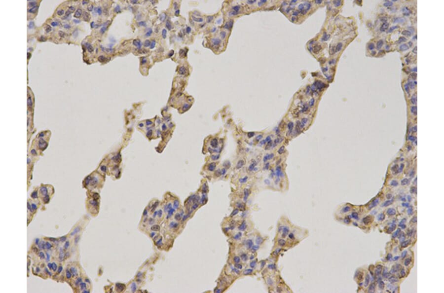 Immunohistochemistry - FABP1 Antibody from Signalway Antibody (32764) - Antibodies.com