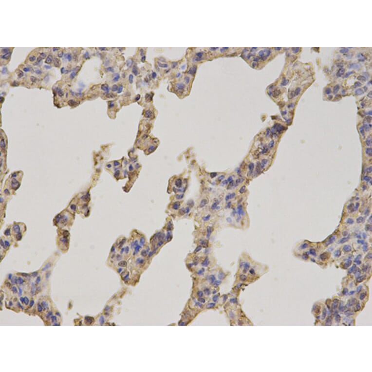 Immunohistochemistry - FABP1 Antibody from Signalway Antibody (32764) - Antibodies.com