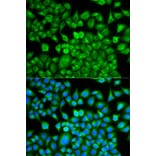 Immunofluorescence - FABP1 Antibody from Signalway Antibody (32764) - Antibodies.com