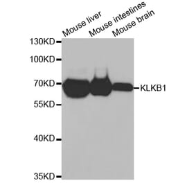 Western blot - KLKB1 Antibody from Signalway Antibody (32768) - Antibodies.com