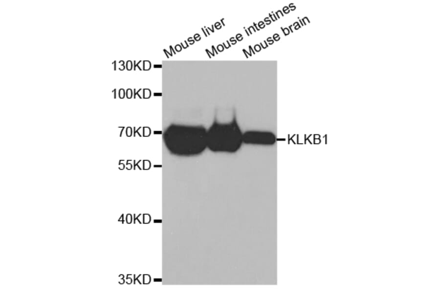 Western blot - KLKB1 Antibody from Signalway Antibody (32768) - Antibodies.com