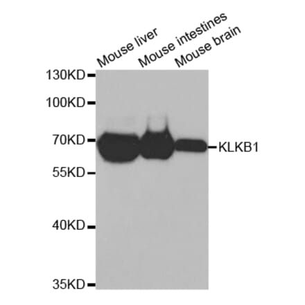 Western blot - KLKB1 Antibody from Signalway Antibody (32768) - Antibodies.com
