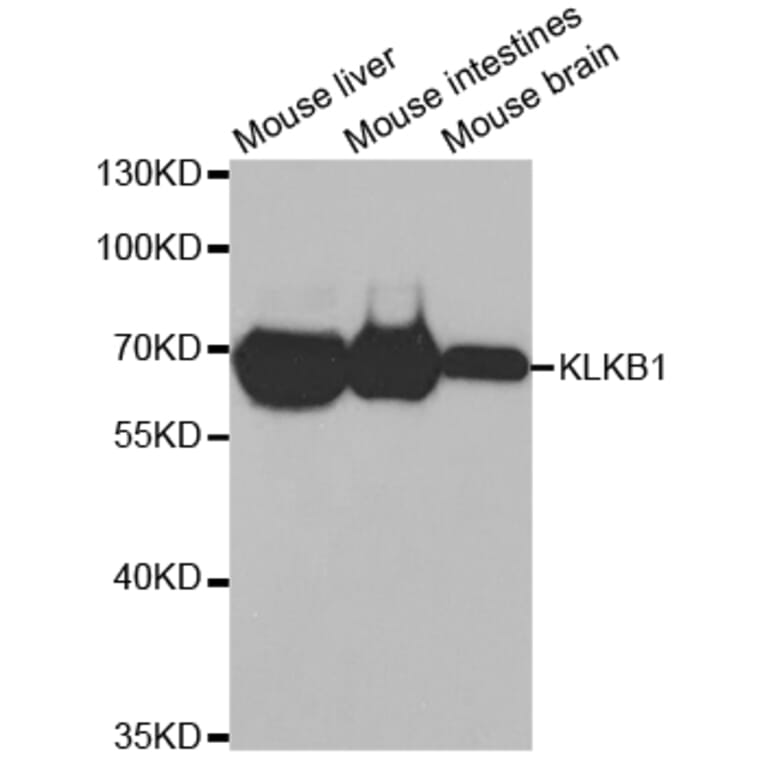 Western blot - KLKB1 Antibody from Signalway Antibody (32768) - Antibodies.com