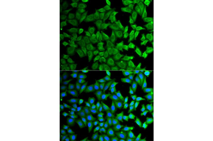 Immunofluorescence - KLKB1 Antibody from Signalway Antibody (32768) - Antibodies.com