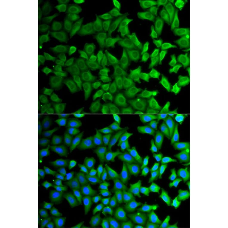 Immunofluorescence - KLKB1 Antibody from Signalway Antibody (32768) - Antibodies.com