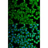 Immunofluorescence - KLKB1 Antibody from Signalway Antibody (32768) - Antibodies.com