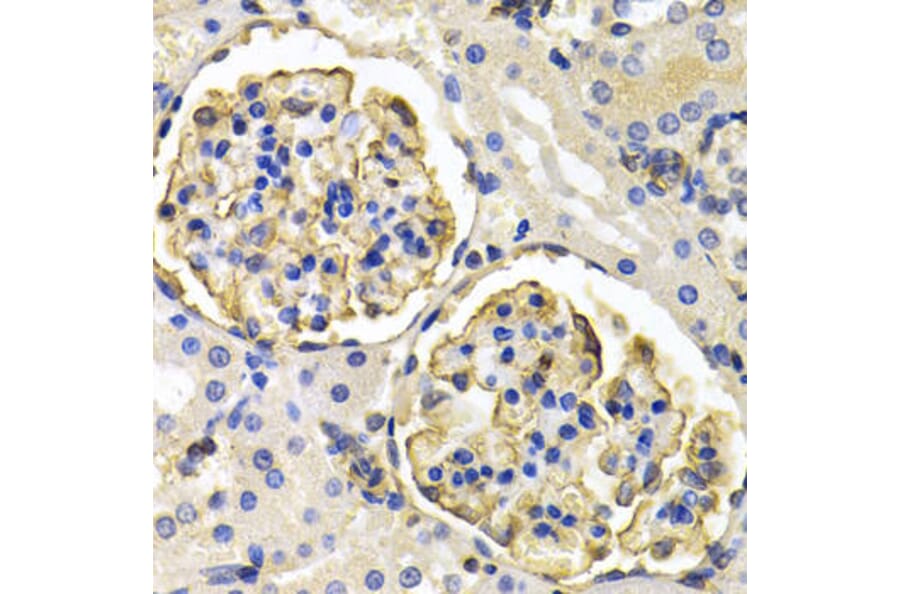 Immunohistochemistry - KLKB1 Antibody from Signalway Antibody (32768) - Antibodies.com