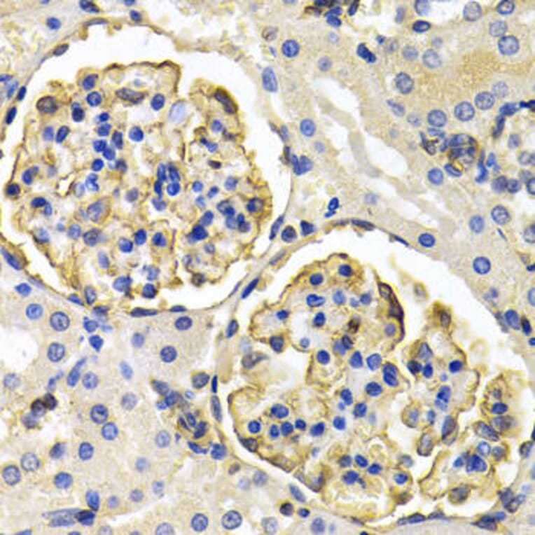 Immunohistochemistry - KLKB1 Antibody from Signalway Antibody (32768) - Antibodies.com