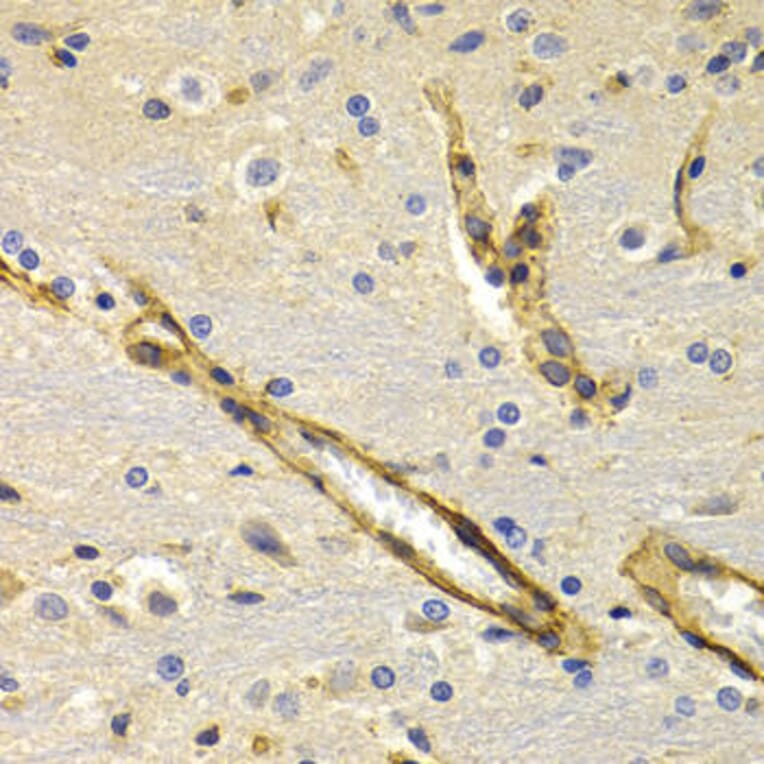 Immunohistochemistry - KLKB1 Antibody from Signalway Antibody (32768) - Antibodies.com