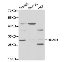 Western blot - RCAN1 Antibody from Signalway Antibody (32774) - Antibodies.com