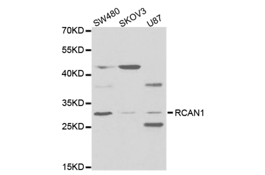 Western blot - RCAN1 Antibody from Signalway Antibody (32774) - Antibodies.com