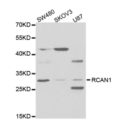 Western blot - RCAN1 Antibody from Signalway Antibody (32774) - Antibodies.com