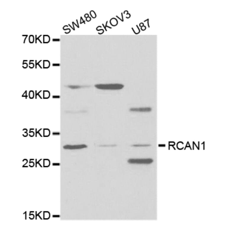 Western blot - RCAN1 Antibody from Signalway Antibody (32774) - Antibodies.com