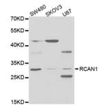 Western blot - RCAN1 Antibody from Signalway Antibody (32774) - Antibodies.com