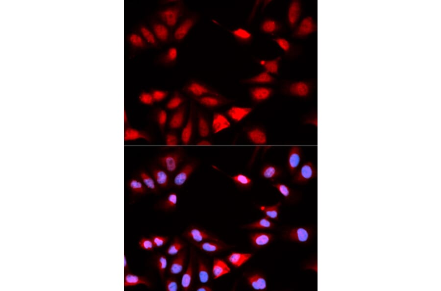 Immunofluorescence - RCAN1 Antibody from Signalway Antibody (32774) - Antibodies.com