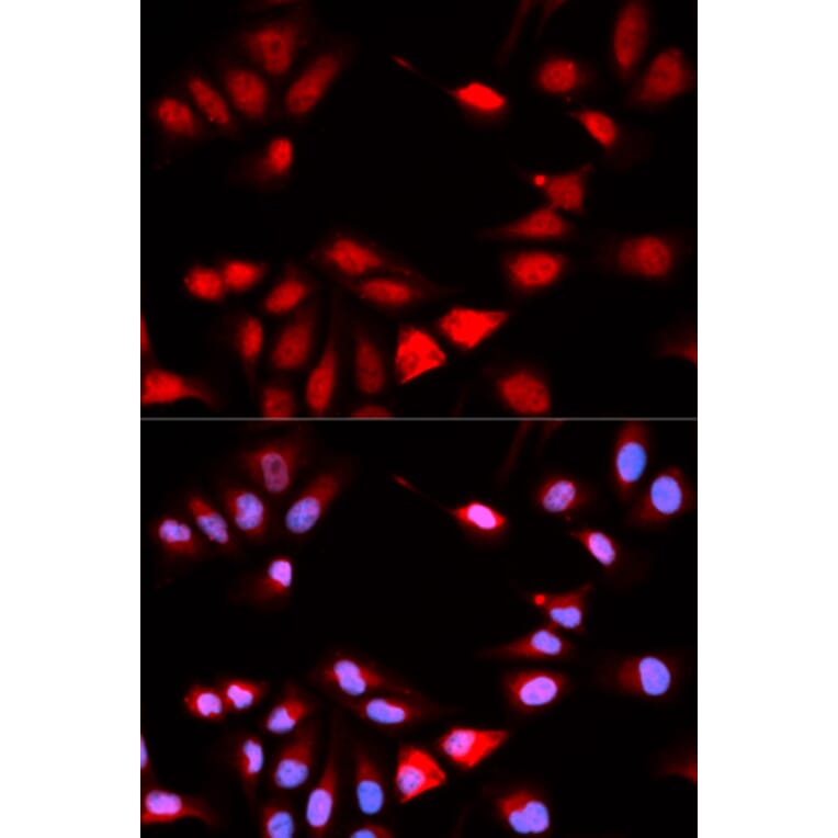 Immunofluorescence - RCAN1 Antibody from Signalway Antibody (32774) - Antibodies.com
