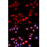 Immunofluorescence - RCAN1 Antibody from Signalway Antibody (32774) - Antibodies.com