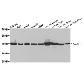 Western blot - ACAT1 Antibody from Signalway Antibody (32779) - Antibodies.com