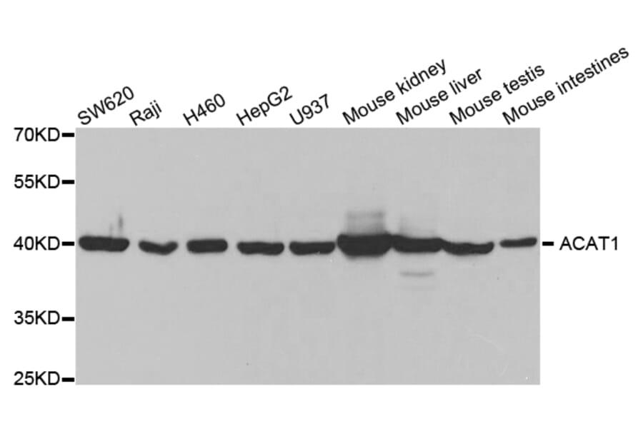 Western blot - ACAT1 Antibody from Signalway Antibody (32779) - Antibodies.com