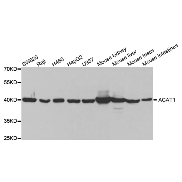Western blot - ACAT1 Antibody from Signalway Antibody (32779) - Antibodies.com