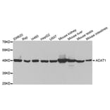 Western blot - ACAT1 Antibody from Signalway Antibody (32779) - Antibodies.com