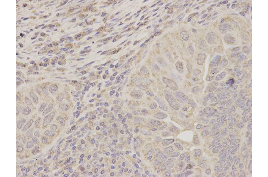 Immunohistochemistry - ACAT1 Antibody from Signalway Antibody (32779) - Antibodies.com
