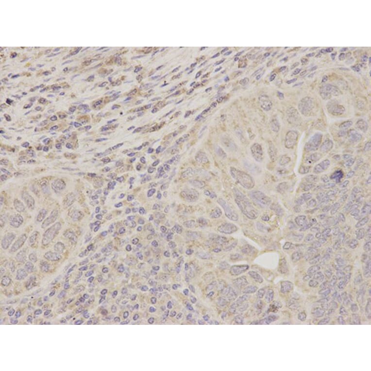 Immunohistochemistry - ACAT1 Antibody from Signalway Antibody (32779) - Antibodies.com