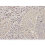 Immunohistochemistry - ACAT1 Antibody from Signalway Antibody (32779) - Antibodies.com