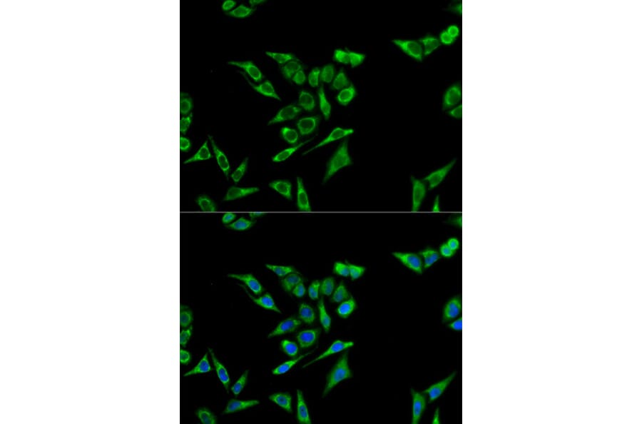 Immunofluorescence - ACAT1 Antibody from Signalway Antibody (32779) - Antibodies.com