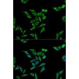 Immunofluorescence - ACAT1 Antibody from Signalway Antibody (32779) - Antibodies.com