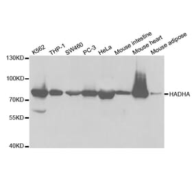Western blot - HADHA Antibody from Signalway Antibody (32787) - Antibodies.com