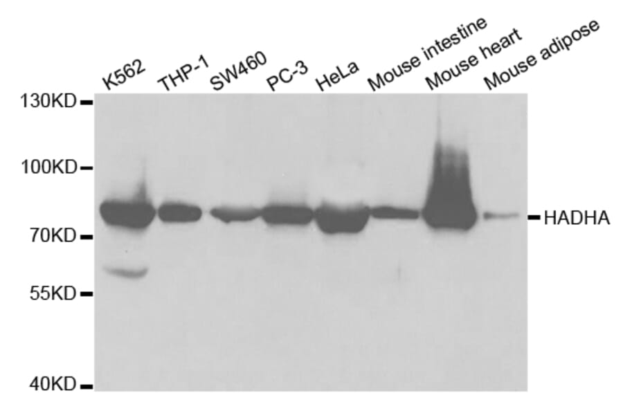 Western blot - HADHA Antibody from Signalway Antibody (32787) - Antibodies.com
