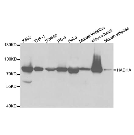 Western blot - HADHA Antibody from Signalway Antibody (32787) - Antibodies.com