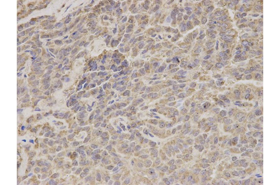 Immunohistochemistry - HADHA Antibody from Signalway Antibody (32787) - Antibodies.com